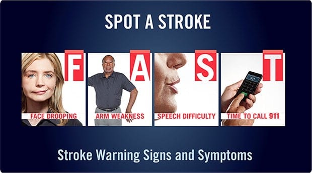 Use FAST for quick stroke  recognition 